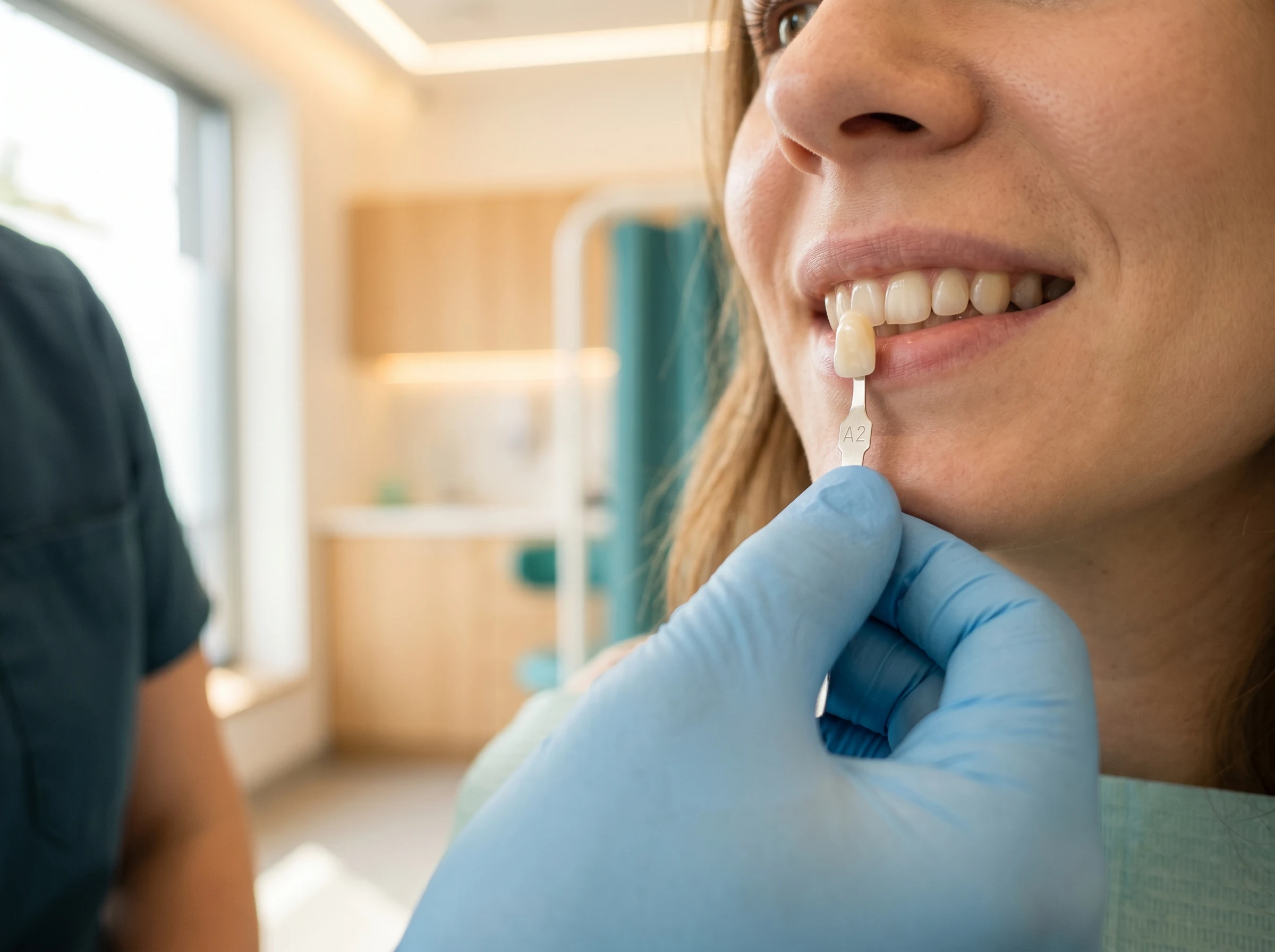 Albire dentară profesională — imagine 2